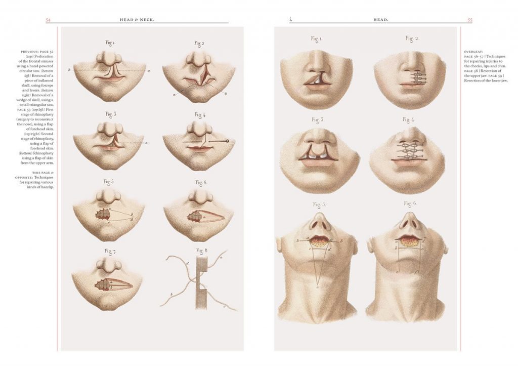 Crucial Interventions