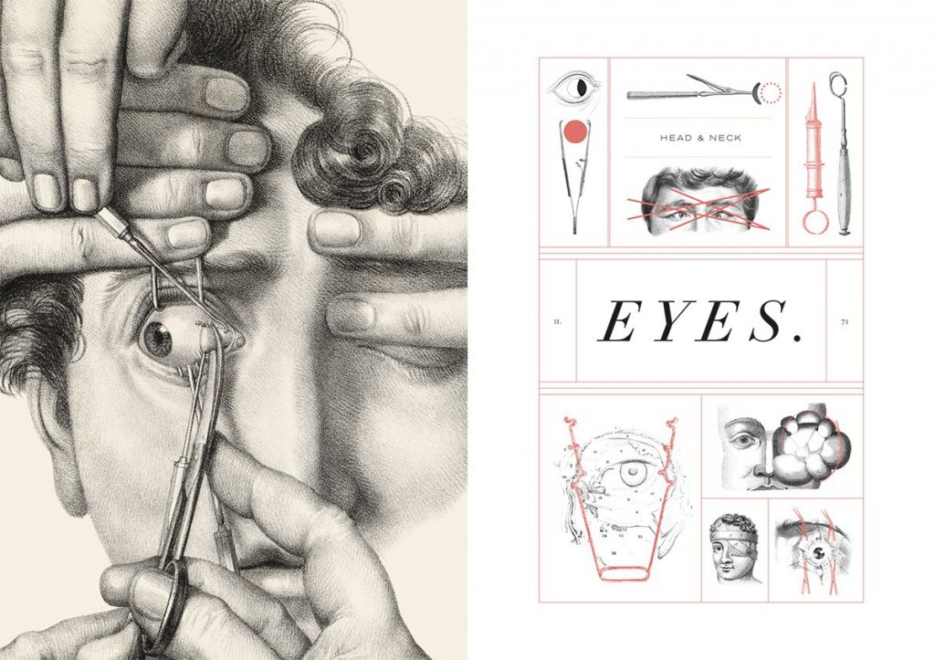 Crucial Interventions