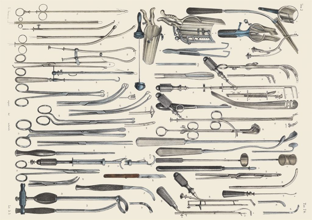 Crucial Interventions