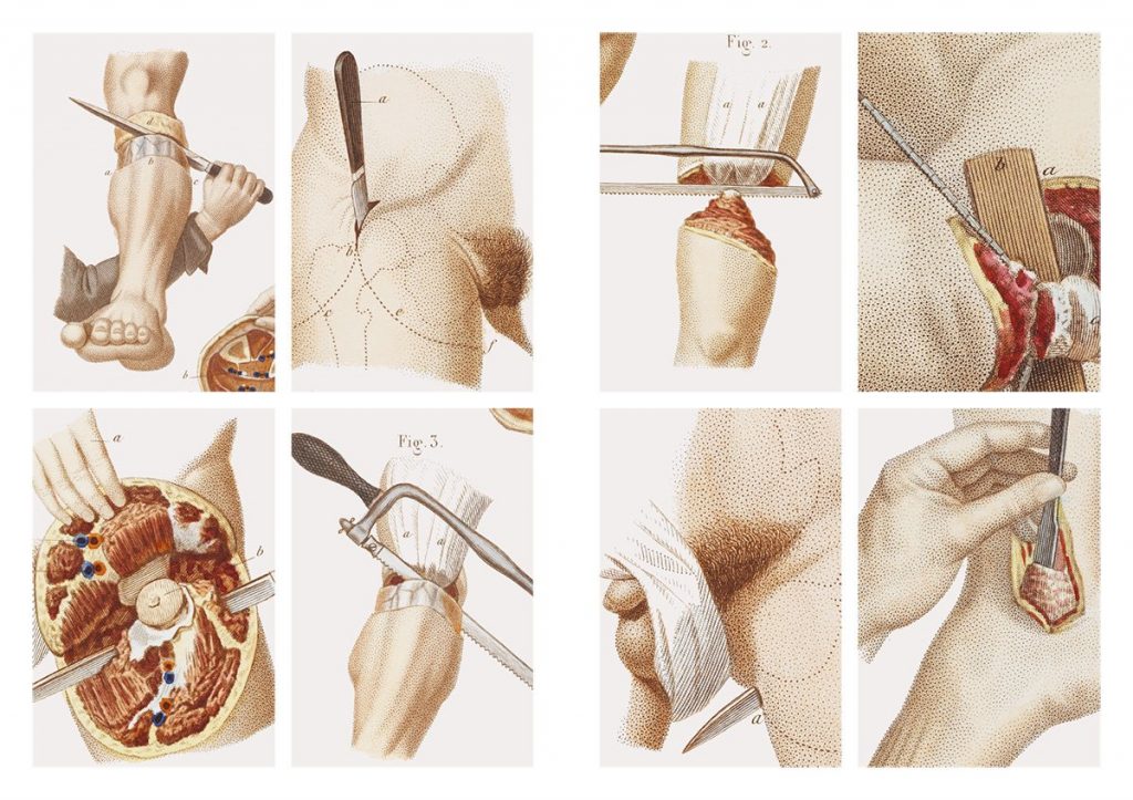 Crucial Interventions