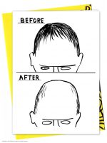 David Shrigley Greetings Card - Before After